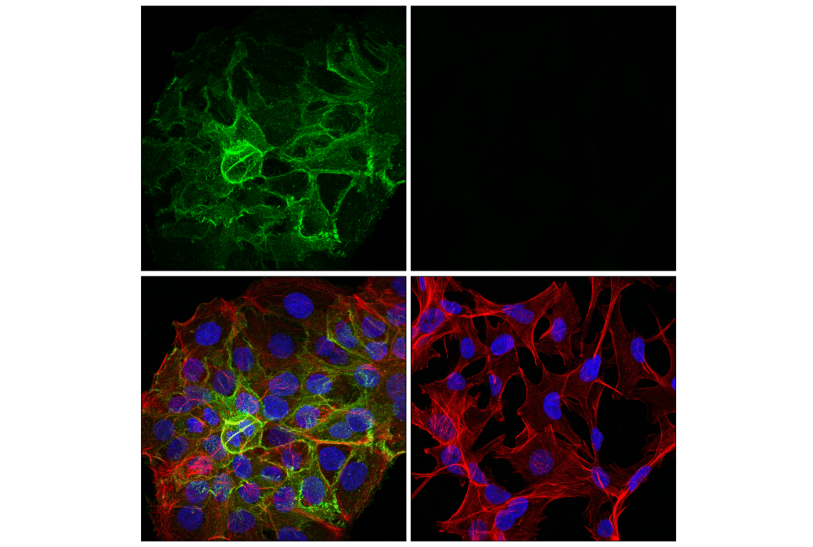 Immunofluorescence Image 1: Desmoglein 3 (5G11) Mouse mAb