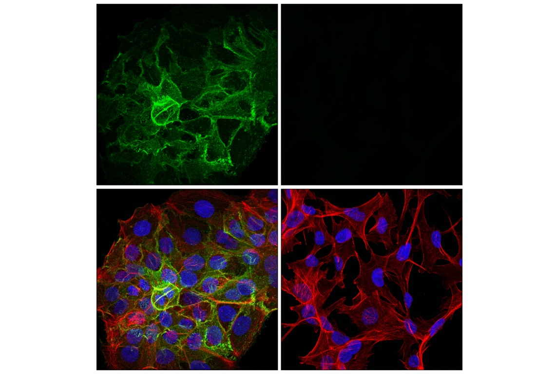 Immunofluorescence Image 1: Desmoglein 3 (5G11) Mouse Monoclonal Antibody