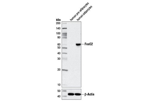 Western Blotting Image 1: FoxC2 (D4D4) Rabbit mAb