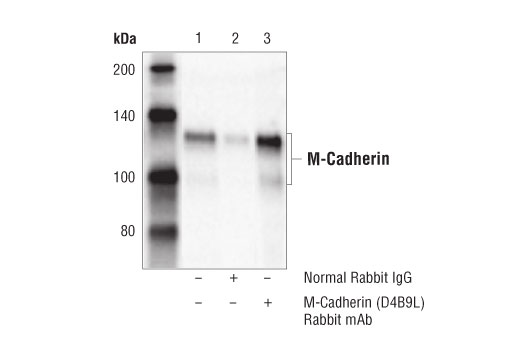 Immunoprecipitation Image 1: M-Cadherin (D4B9L) Rabbit Monoclonal Antibody
