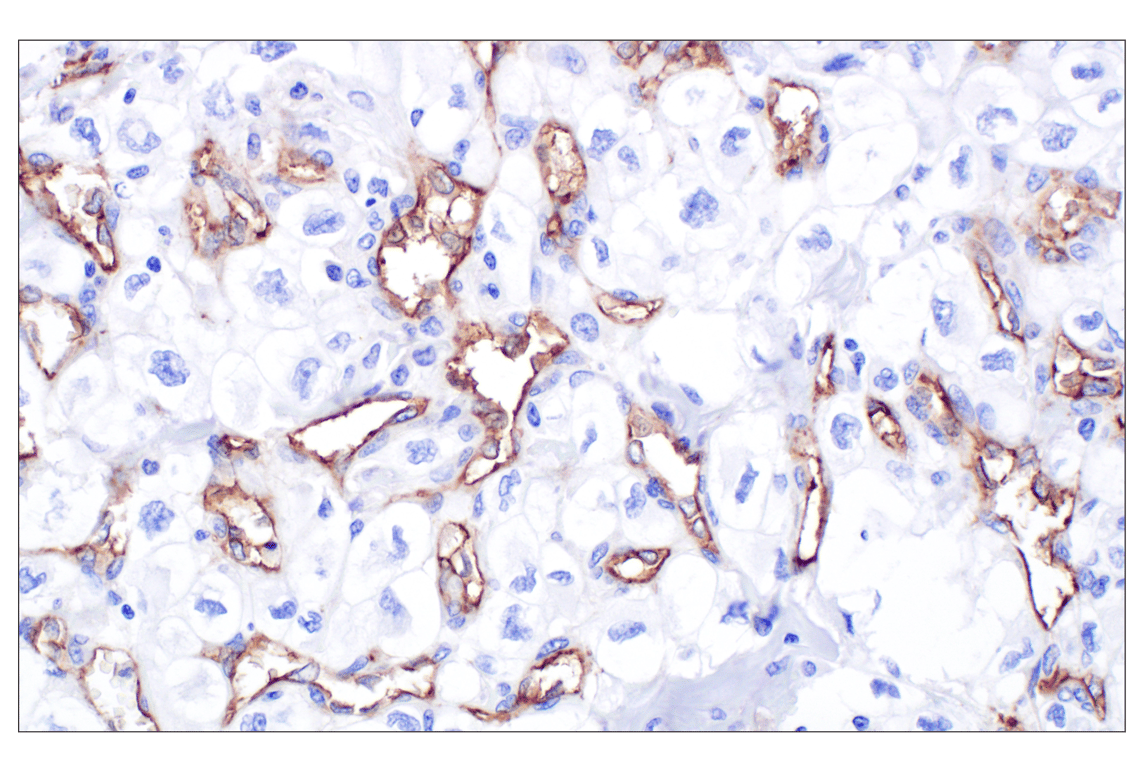 Immunohistochemistry Image 3: CD105/Endoglin (F9C5Q) Rabbit Monoclonal Antibody (BSA and Azide Free)