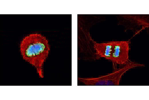 Immunofluorescence Image 1: Phospho-Histone H3 (Ser10) (D2C8) Rabbit Monoclonal Antibody
