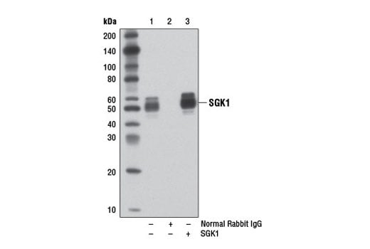 Immunoprecipitation Image 1: SGK1 (D27C11) Rabbit Monoclonal Antibody