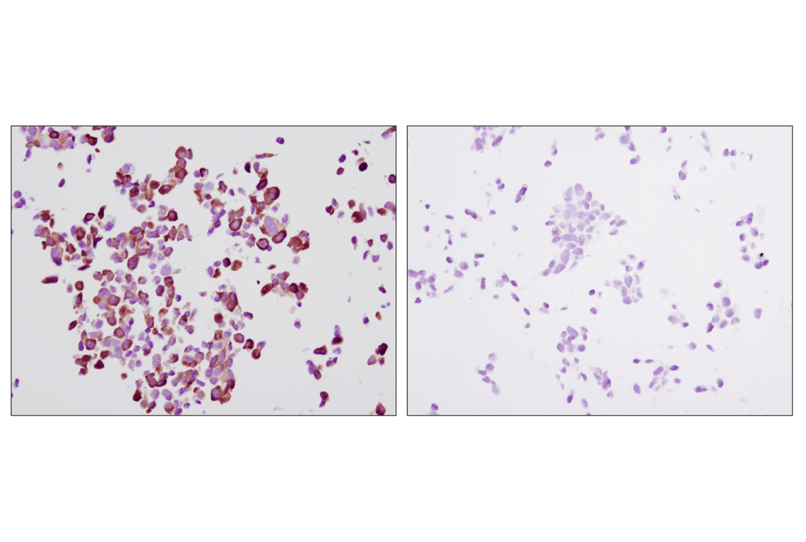 undefined Image 36: Translational Control Antibody Sampler Kit