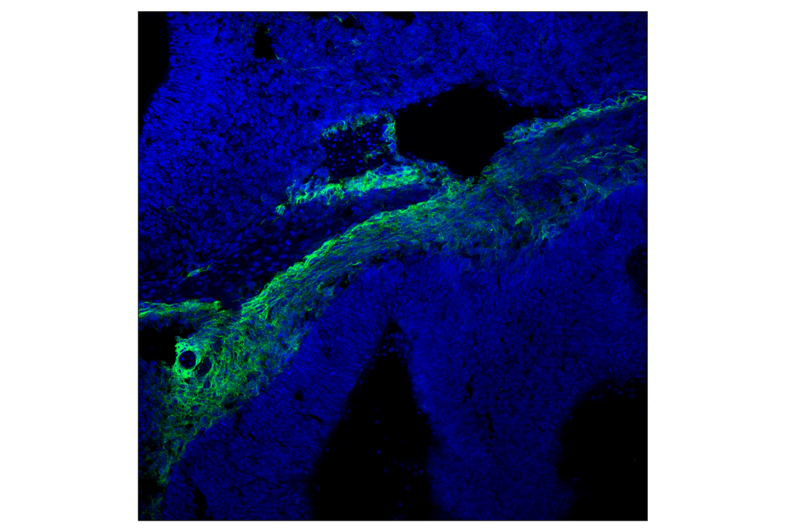 Immunofluorescence Image 2: p75NTR (F2L9S) Rabbit Monoclonal Antibody