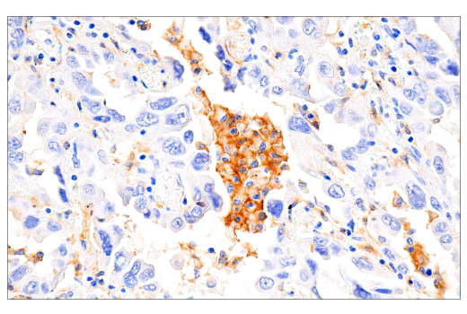 Immunohistochemistry Image 4: GM-CSF Receptor alpha (E8Z3S) Rabbit Monoclonal Antibody (BSA and Azide Free)