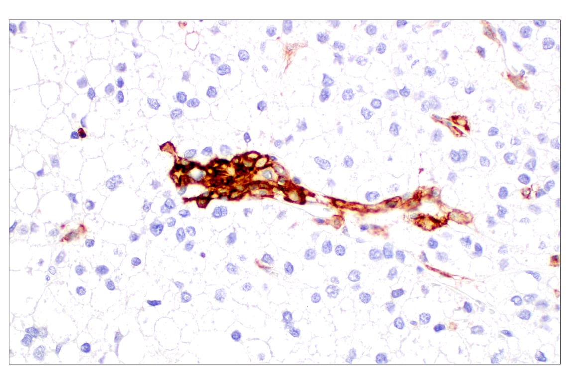 Immunohistochemistry Image 3: CD11b/ITGAM (E3J2F) Rabbit Monoclonal Antibody