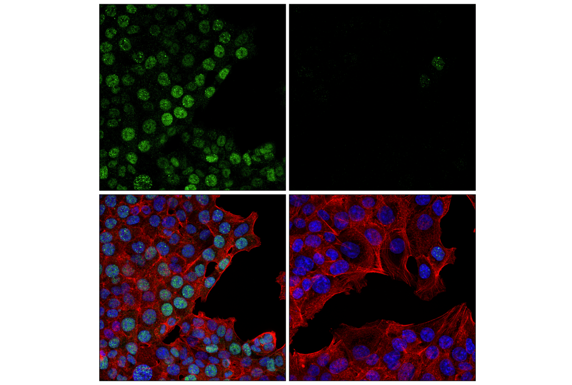 Immunofluorescence Image 1: Rad51 (F1G6C) Rabbit Monoclonal Antibody