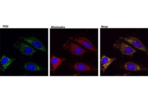 undefined Image 16: Gluconeogenesis Antibody Sampler Kit