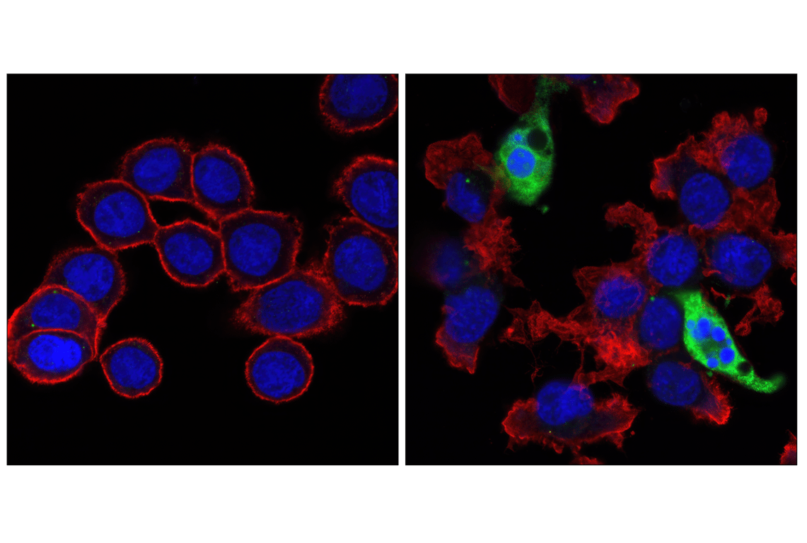 undefined Image 20: Apoptosis Antibody Sampler Kit (Mouse Preferred)