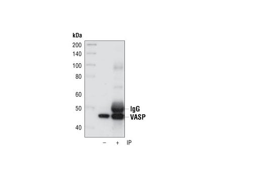 undefined Image 11: Actin Reorganization Antibody Sampler Kit