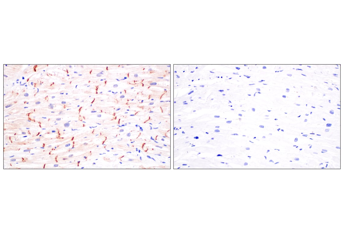 Immunohistochemistry Image 10: Desmoplakin (F3J8Y) Rabbit Monoclonal Antibody