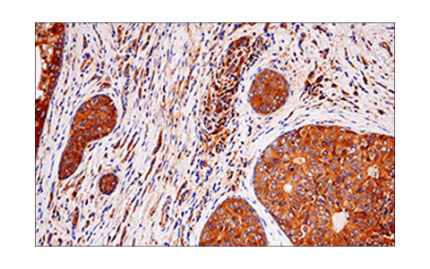 Immunohistochemistry Image 2: RIP (E8S7U) Rabbit Monoclonal Antibody (BSA and Azide Free)