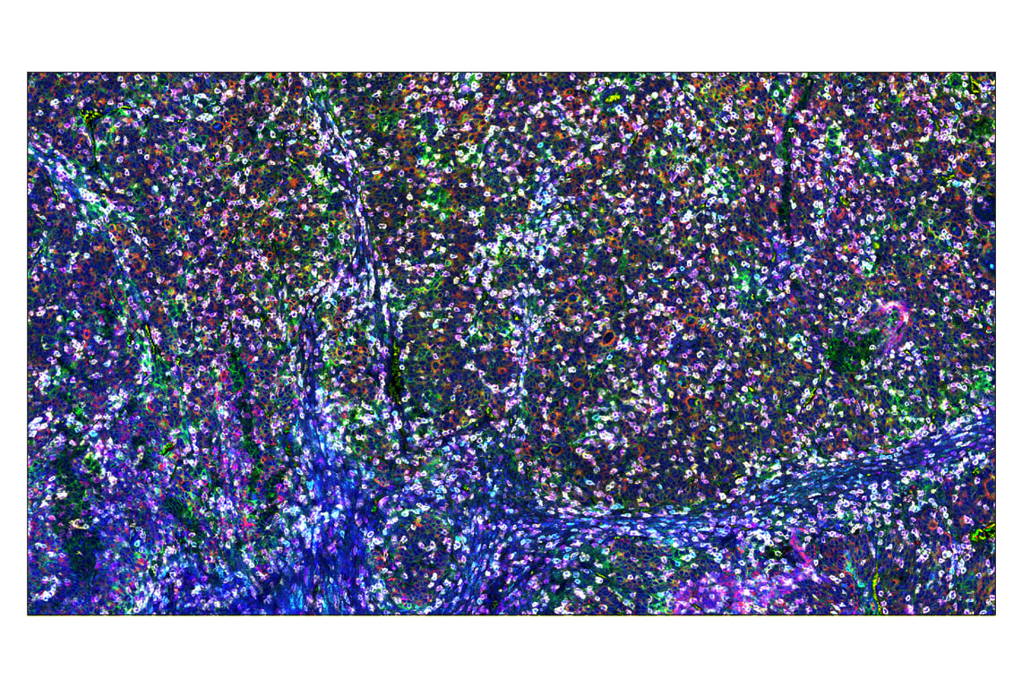 Immunohistochemistry Image 7: PD-L1 (E1L3N<sup>®</sup>) & CO-0005-594 SignalStar<sup>™</sup> Oligo-Antibody Pair