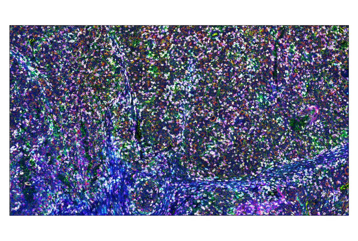 Immunohistochemistry Image 7: PD-L1 (E1L3N<sup>®</sup>) & CO-0005-647 SignalStar<sup>™</sup> Oligo-Antibody Pair