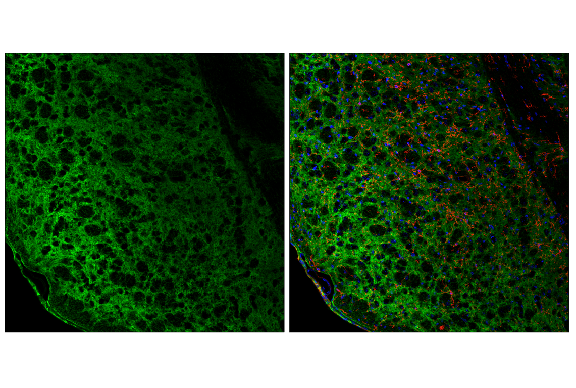 Immunofluorescence Image 2: EAAT1 (F8N7H) Mouse Monoclonal Antibody