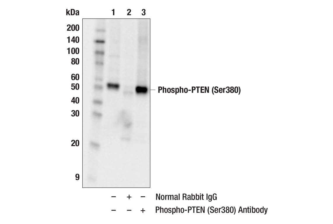 undefined Image 39: Phospho-Akt Pathway Antibody Sampler Kit