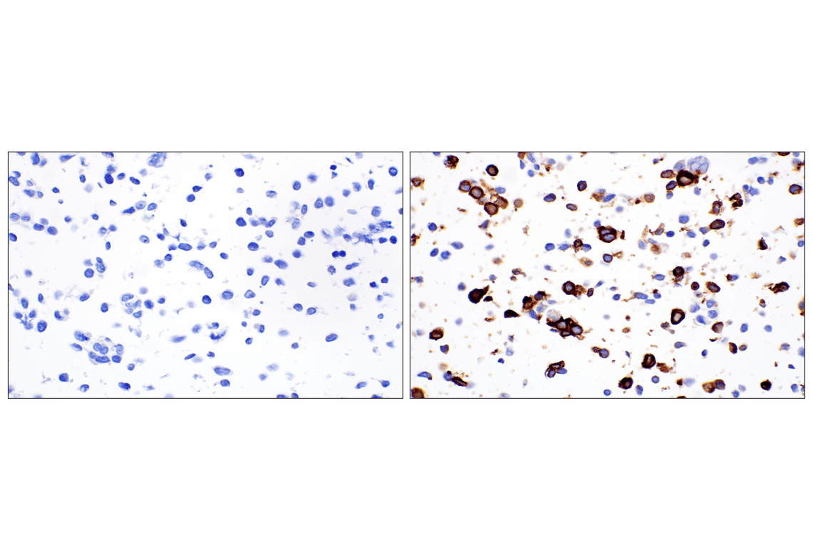 Immunohistochemistry Image 9: NCR1/NKp46 (F8M2L) Rabbit Monoclonal Antibody (IHC Formulated)