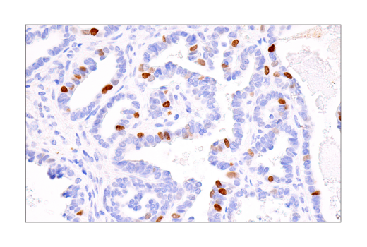 Immunohistochemistry Image 1: ATAD2 (E8Y7F) Rabbit Monoclonal Antibody