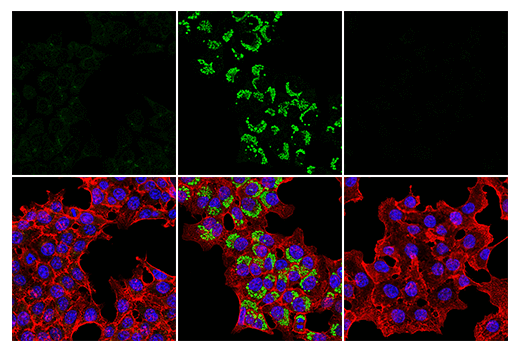 undefined Image 47: Xenophagy Antibody Sampler Kit