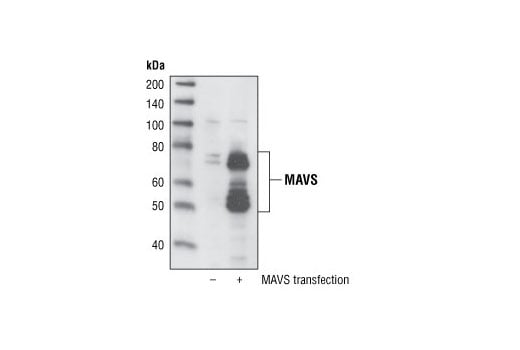 undefined Image 13: Rig-I Pathway Antibody Sampler Kit