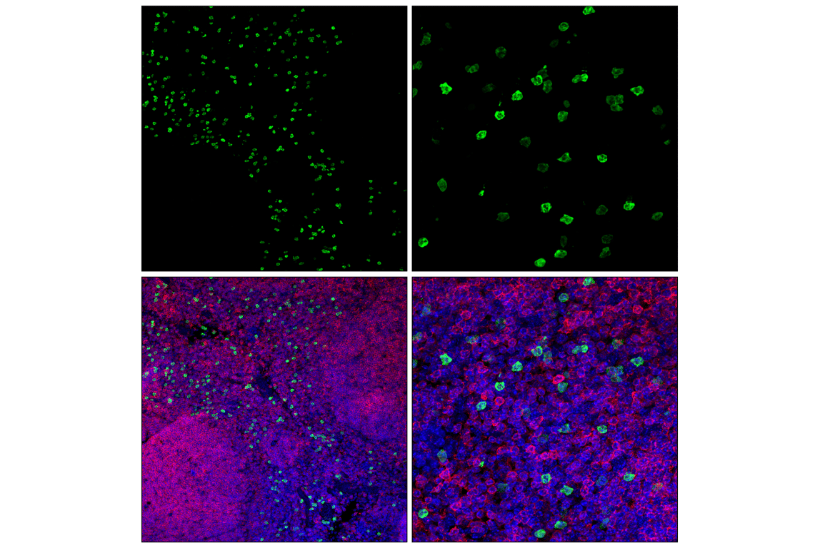 Immunofluorescence Image 1: S100A9 (D3U8M) Rabbit Monoclonal Antibody (Alexa Fluor<sup>®</sup> 488 Conjugate)