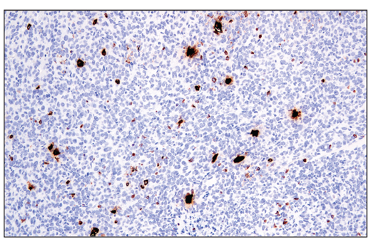 Immunohistochemistry Image 1: Perforin (E3W4I) Rabbit Monoclonal Antibody