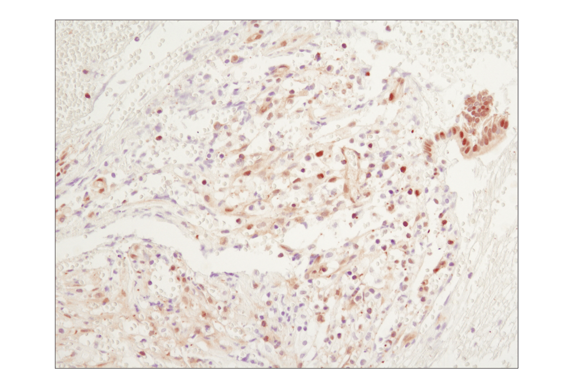 Immunohistochemistry Image 2: NF-kappaB p65 (D14E12) Rabbit Monoclonal Antibody (BSA and Azide Free)