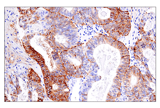 Immunohistochemistry Image 5: HLA-DRA (E9R2Q) XP<sup>®</sup> Rabbit mAb (BSA and Azide Free)