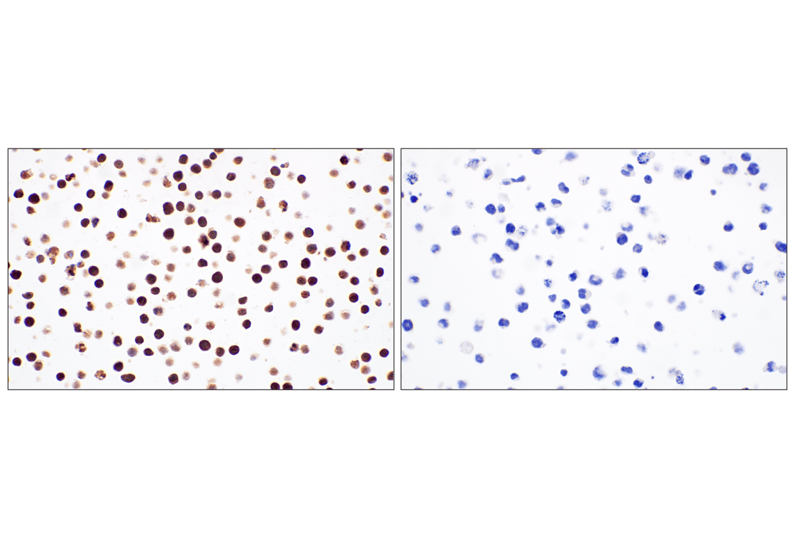 Immunohistochemistry Image 8: TCL1 (F9R1X) Rabbit Monoclonal Antibody