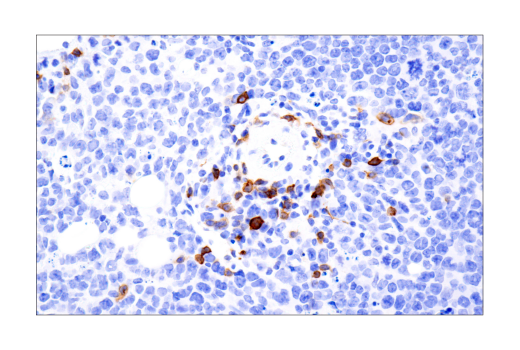 Immunohistochemistry Image 2: IL-2R alpha/CD25 (E9W2J) Rabbit Monoclonal Antibody