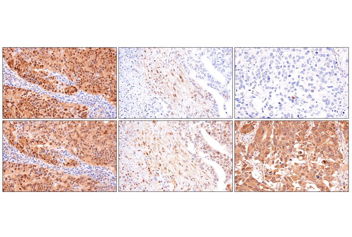 Immunohistochemistry Image 12: Phospho-ATP-Citrate Lyase (Ser455) (F4T8R) Rabbit Monoclonal Antibody
