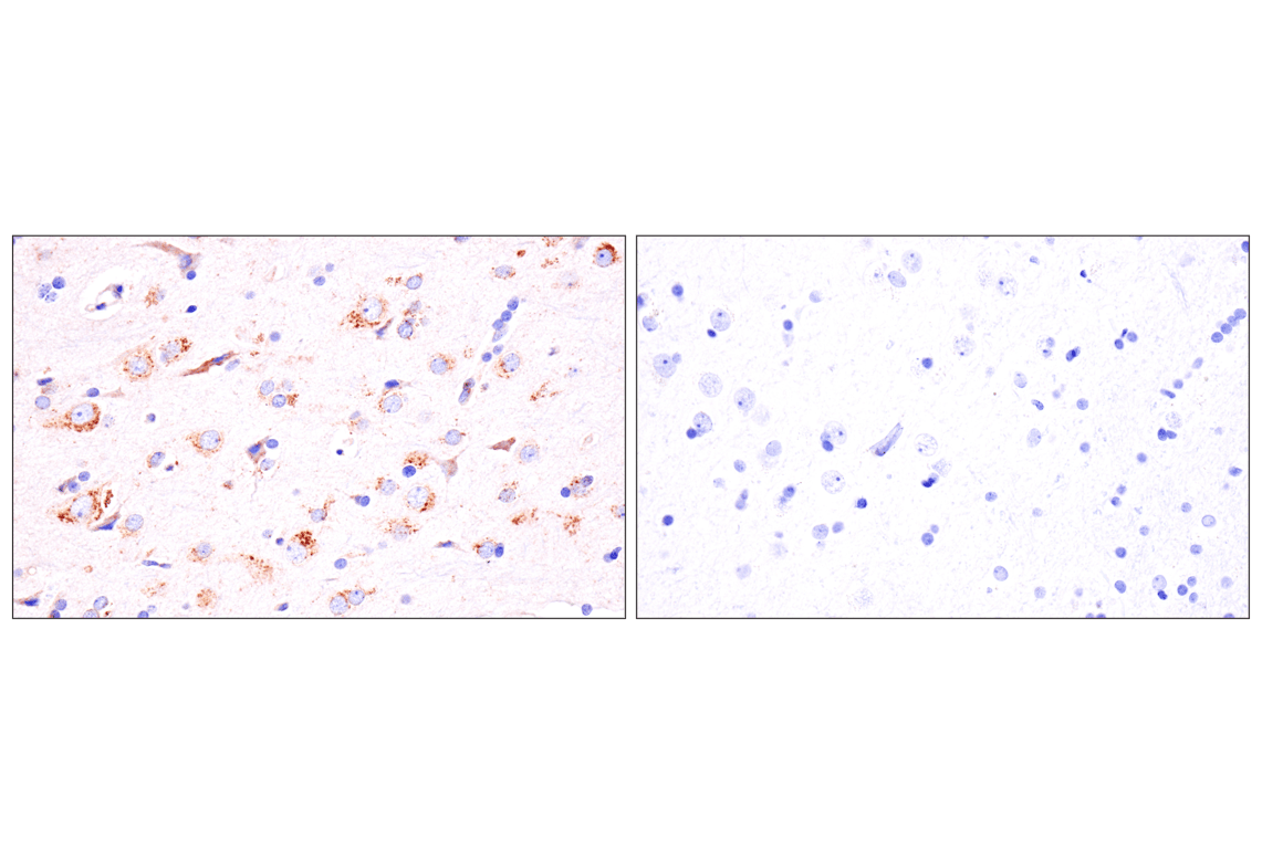Immunohistochemistry Image 11: Presenilin 2 (F7E5Q) Rabbit Monoclonal Antibody