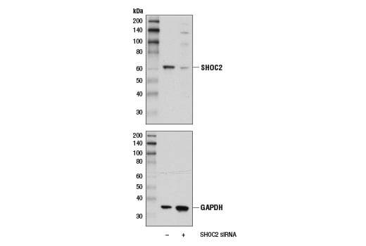 Western Blotting Image 3: SHOC2 (D7N1A) Rabbit Monoclonal Antibody
