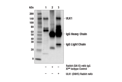undefined Image 23: Autophagy Induction (ULK1 Complex) Antibody Sampler Kit