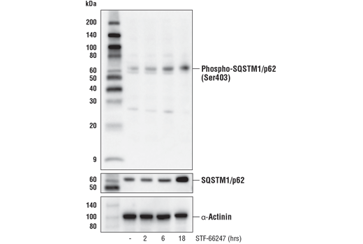 Western Blotting Image 4: Phospho-SQSTM1/p62 (Ser403) (D8D6T) Rabbit Monoclonal Antibody