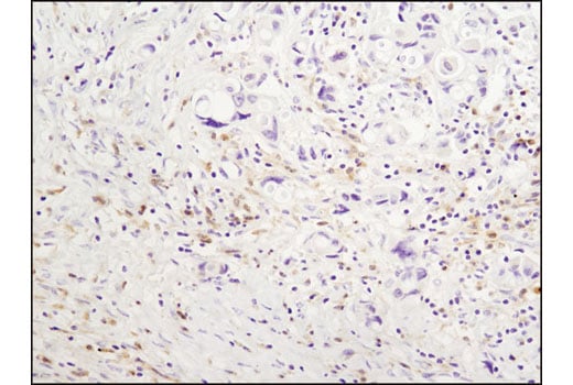 Immunohistochemistry Image 1: Syk (D3Z1E) Rabbit Monoclonal Antibody (BSA and Azide Free)