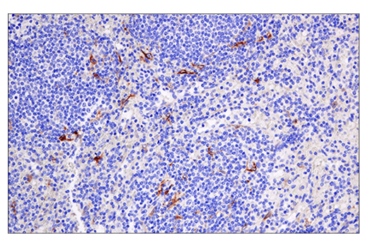 Immunohistochemistry Image 4: Cleaved Gasdermin D (Asp275) (E7H9G) Rabbit Monoclonal Antibody (BSA and Azide Free)