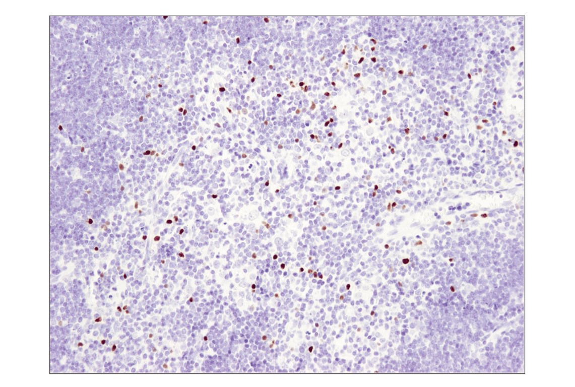 Immunohistochemistry Image 1: FoxP3 (D6O8R) Rabbit Monoclonal Antibody (BSA and Azide Free)