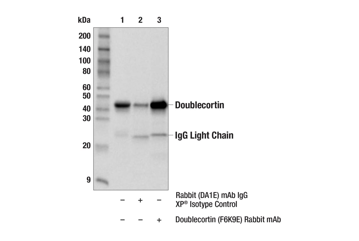 Immunoprecipitation Image 1: Doublecortin (F6K9E) Rabbit Monoclonal Antibody