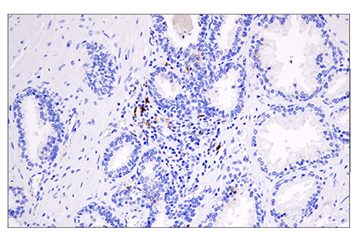 Immunohistochemistry Image 5: Cleaved Gasdermin D (Asp275) (E7H9G) Rabbit Monoclonal Antibody (BSA and Azide Free)