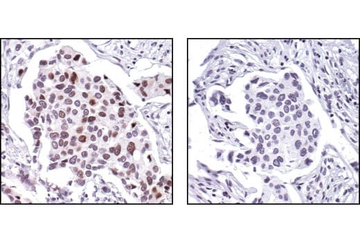 Immunohistochemistry Image 3: Phospho-Cyclin E1 (Thr62) Antibody