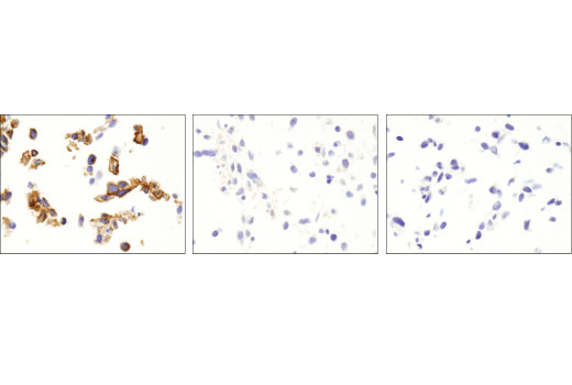 Immunohistochemistry Image 1: TrkA (12G8) Rabbit Monoclonal Antibody