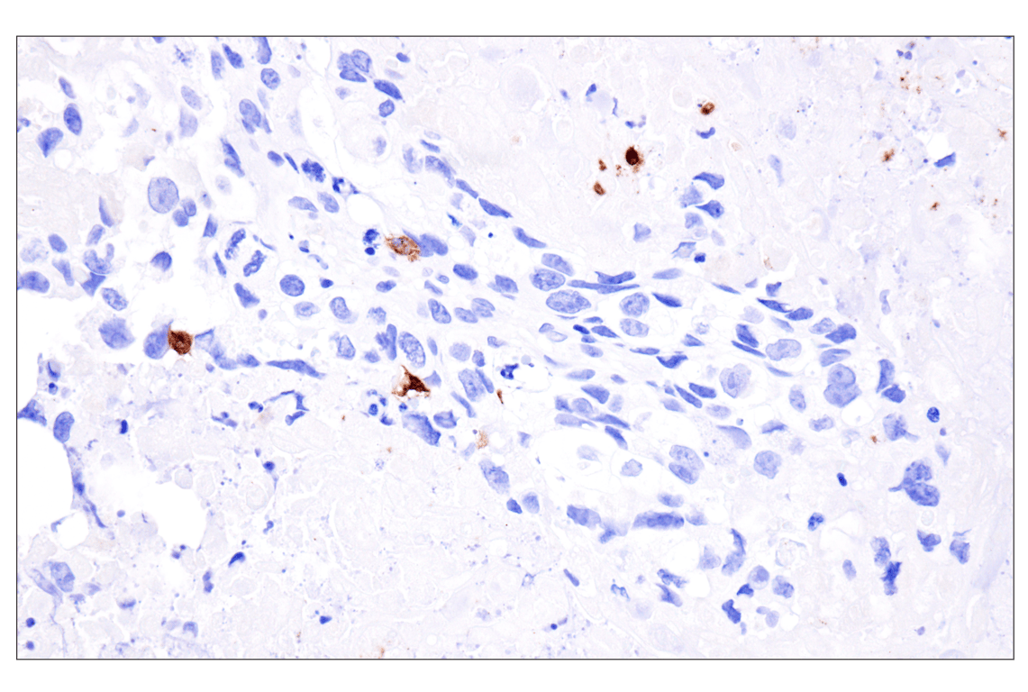 Immunohistochemistry Image 2: Langerin (F8L8I) Rabbit Monoclonal Antibody
