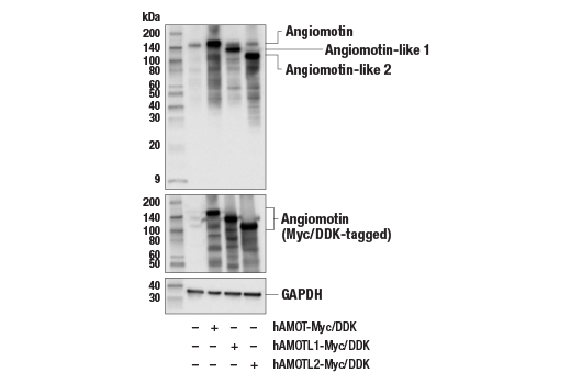 Western Blotting Image 2: Angiomotin (E3E7X) Rabbit Monoclonal Antibody