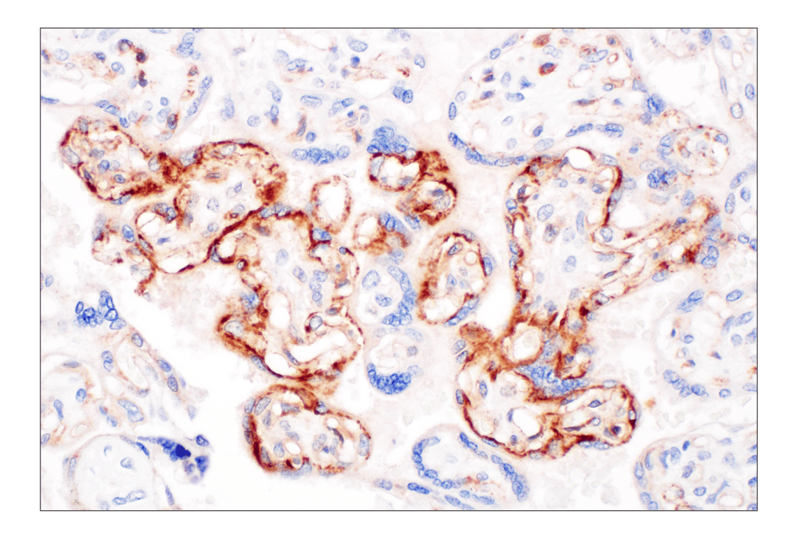 Immunohistochemistry Image 5: LY6E (F8Y1R) Rabbit Monoclonal Antibody