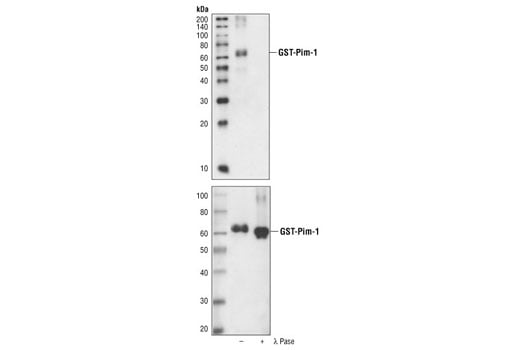 Western Blotting Image 2: Phospho-Pim-1 (Tyr218) Antibody