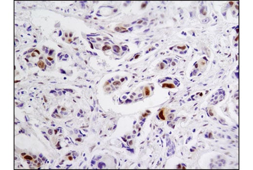 Immunohistochemistry Image 1: Vitamin D3 Receptor (D2K6W) Rabbit Monoclonal Antibody