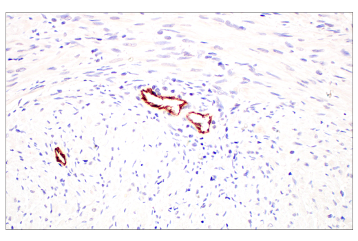 Immunohistochemistry Image 9: PLVAP (E3X9D) Rabbit Monoclonal Antibody