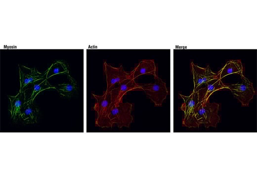 Immunofluorescence Image 1: Myosin IIb (D8H8) Rabbit Monoclonal Antibody